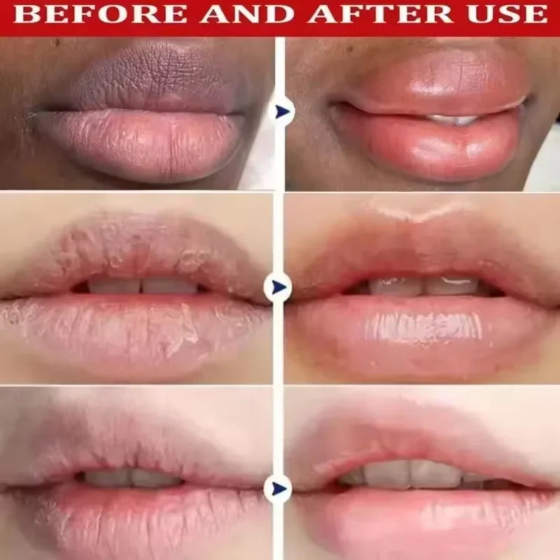 Rose Lip Balm